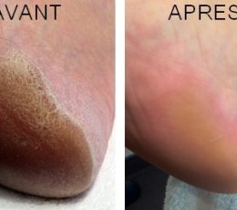 🔆Objectif pieds parfaits🔆