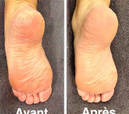 🔆Objectif pieds parfaits🔆